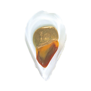 Silver foiled Glass Pendants 15556